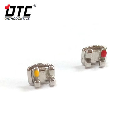 DTC Bright Series Metal Brackets The Key to Successful Class II Orthodontic Treatment