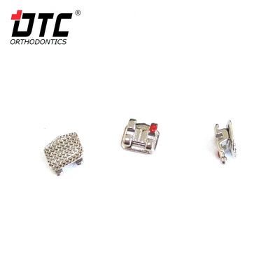 DTC Bright Series Metal Brackets The Key to Successful Class II Orthodontic Treatment