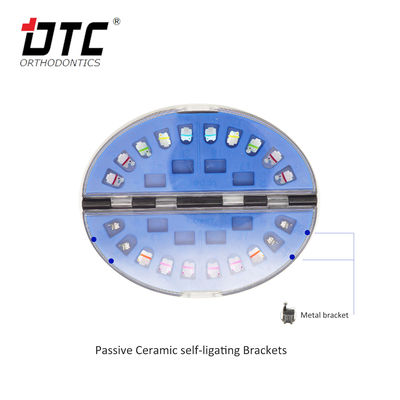 Revolutionize Orthodontic Treatment with CE Certified Self-Ligating Ceramic Braces