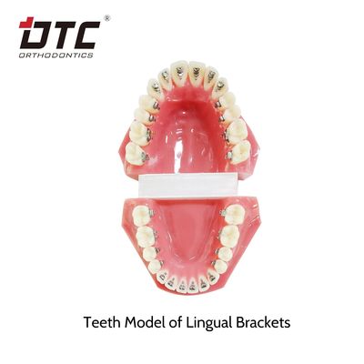CE Standard DTC Orthodontic Lingual Brackets for Mini Size Orthodontic Treatment
