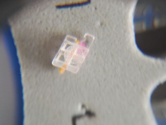 Orthodontic Treatment with DTC Sapphire Bracket Dental Brace ISO Standard