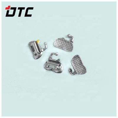 Stainless Steel Convertible Single Buccal Tubes The Ultimate Solution for Orthodontic