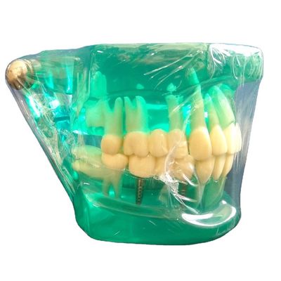 DTC Orthodontic Dental Typodont Brackets Model Custom Made for Manual and OEM