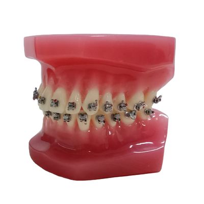 DTC Orthodontic Dental Typodont Brackets Model Custom Made for Manual and OEM
